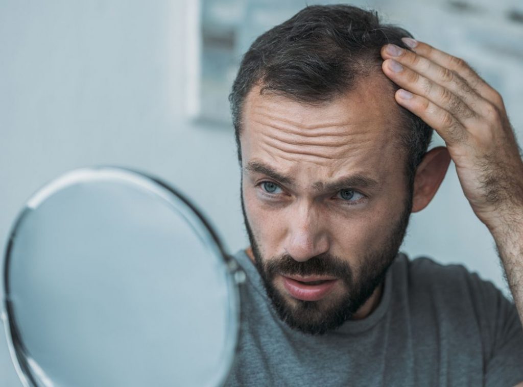 Sette possibili modi per evitare la caduta dei capelli